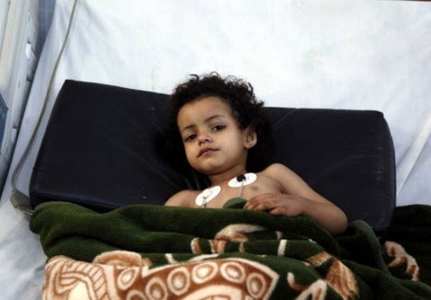 Diphtheria new epidemic That Has Killed Many Victims in Yemen